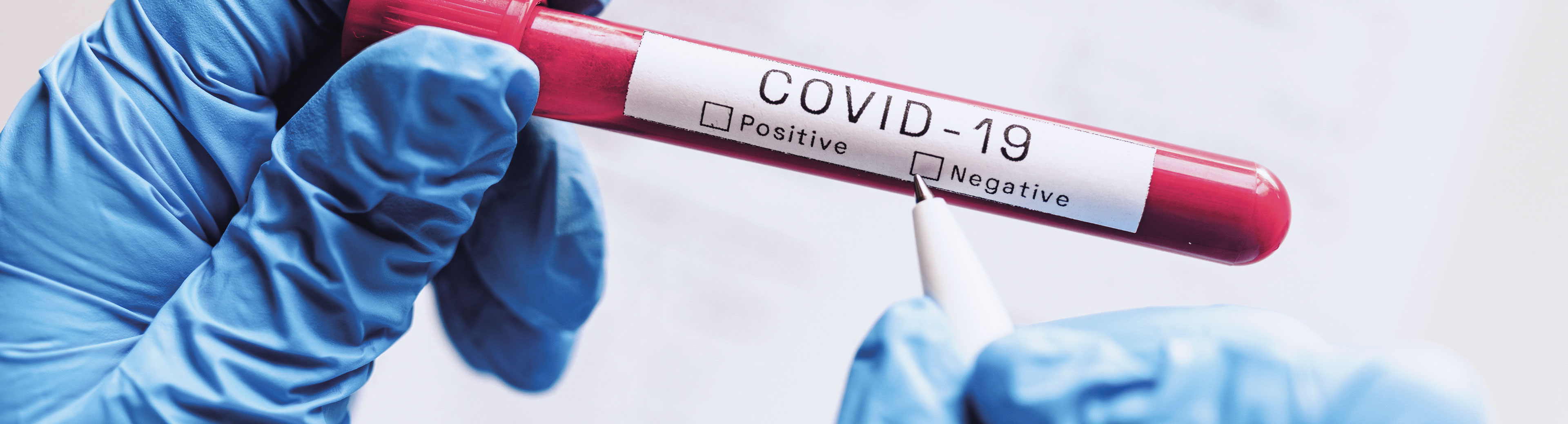 Bluttest für Coronavirus